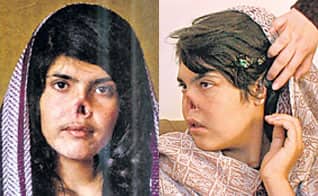  Talibans give real nose cut to a afghan woman பெண்ணின் மூக்கை துண்டித்த தலிபான்கள்: ஆப்கனில் கொடூரம்