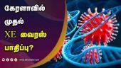 கேரளாவில் முதல் XE வைரஸ் பாதிப்பு? | XE Virus | Covid 19 | Kerala | Dinamalar
