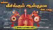 கொரோனாவுக்கு பின் ஆஸ்துமாவின் தாக்கம்|வீசிங் vs ஆஸ்துமா|World Asthma day|Kauvery Hospital|Dinamalar
