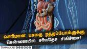 அப்போலோவில் திறக்கப்படும் உயர் சிகிச்சை மையம்! | Apollo Hospital | Chennai Apollo | GI Bleed